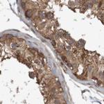 ARHGEF11 Antibody in Immunohistochemistry (IHC)