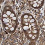 ARHGEF11 Antibody in Immunohistochemistry (IHC)