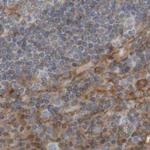 ARHGEF11 Antibody in Immunohistochemistry (IHC)