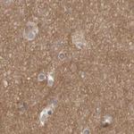 ARHGEF11 Antibody in Immunohistochemistry (IHC)