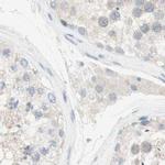 MANEA Antibody in Immunohistochemistry (IHC)