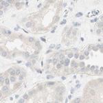 MANEA Antibody in Immunohistochemistry (IHC)