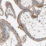 SEMA4C Antibody in Immunohistochemistry (IHC)