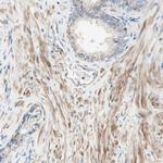 SEMA4C Antibody in Immunohistochemistry (IHC)