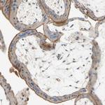 SEMA4C Antibody in Immunohistochemistry (IHC)