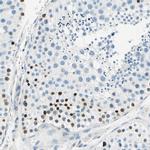 PASD1 Antibody in Immunohistochemistry (IHC)