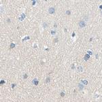 PASD1 Antibody in Immunohistochemistry (IHC)