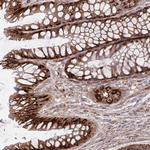 ASAP1 Antibody in Immunohistochemistry (Paraffin) (IHC (P))