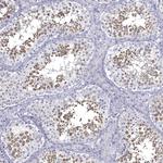 GALNTL5 Antibody in Immunohistochemistry (Paraffin) (IHC (P))