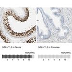 GALNTL5 Antibody