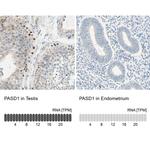 PASD1 Antibody in Immunohistochemistry (IHC)