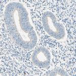 PASD1 Antibody in Immunohistochemistry (IHC)