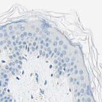 PASD1 Antibody in Immunohistochemistry (IHC)