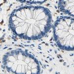 PASD1 Antibody in Immunohistochemistry (IHC)