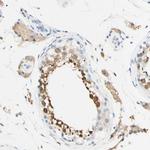 FGF4 Antibody in Immunohistochemistry (Paraffin) (IHC (P))