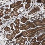 EFCAB14 Antibody in Immunohistochemistry (Paraffin) (IHC (P))