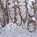 RPL10 Antibody in Immunohistochemistry (IHC)