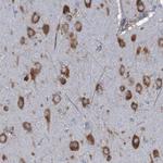 RPL10 Antibody in Immunohistochemistry (IHC)