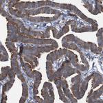 RPL10 Antibody in Immunohistochemistry (IHC)