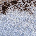 SPINK5 Antibody in Immunohistochemistry (IHC)