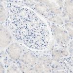 SPINK5 Antibody in Immunohistochemistry (IHC)