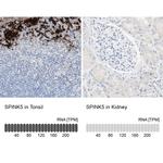 SPINK5 Antibody