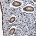 Cdc5L Antibody in Immunohistochemistry (Paraffin) (IHC (P))