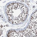 Cdc5L Antibody in Immunohistochemistry (Paraffin) (IHC (P))