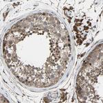 CHST9 Antibody in Immunohistochemistry (Paraffin) (IHC (P))