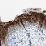 UPK3BL Antibody in Immunohistochemistry (Paraffin) (IHC (P))