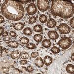 Stomatin Antibody in Immunohistochemistry (IHC)