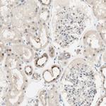 RFNG Antibody in Immunohistochemistry (IHC)