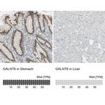 GALNT6 Antibody in Immunohistochemistry (IHC)