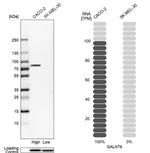 GALNT6 Antibody in Western Blot (WB)