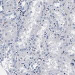 LRIG1 Antibody in Immunohistochemistry (IHC)