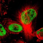 Cullin 4B Antibody in Immunocytochemistry (ICC/IF)