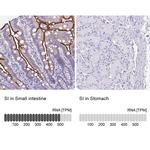 SI Antibody in Immunohistochemistry (IHC)