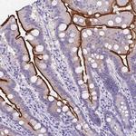 SI Antibody in Immunohistochemistry (IHC)