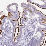 SI Antibody in Immunohistochemistry (IHC)