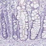 SI Antibody in Immunohistochemistry (IHC)