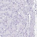 SI Antibody in Immunohistochemistry (IHC)