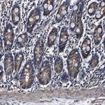 Alix Antibody in Immunohistochemistry (Paraffin) (IHC (P))