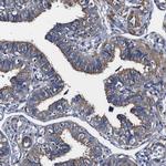 Alix Antibody in Immunohistochemistry (Paraffin) (IHC (P))