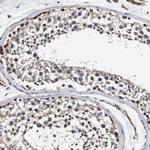 Alix Antibody in Immunohistochemistry (Paraffin) (IHC (P))