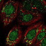 DHODH Antibody in Immunocytochemistry (ICC/IF)