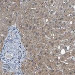 DHODH Antibody in Immunohistochemistry (Paraffin) (IHC (P))