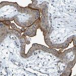 DHODH Antibody in Immunohistochemistry (Paraffin) (IHC (P))