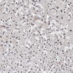 CHD4 Antibody in Immunohistochemistry (Paraffin) (IHC (P))