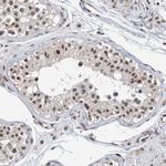 CHD4 Antibody in Immunohistochemistry (Paraffin) (IHC (P))