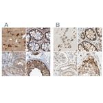 LRRC47 Antibody in Immunohistochemistry (IHC)